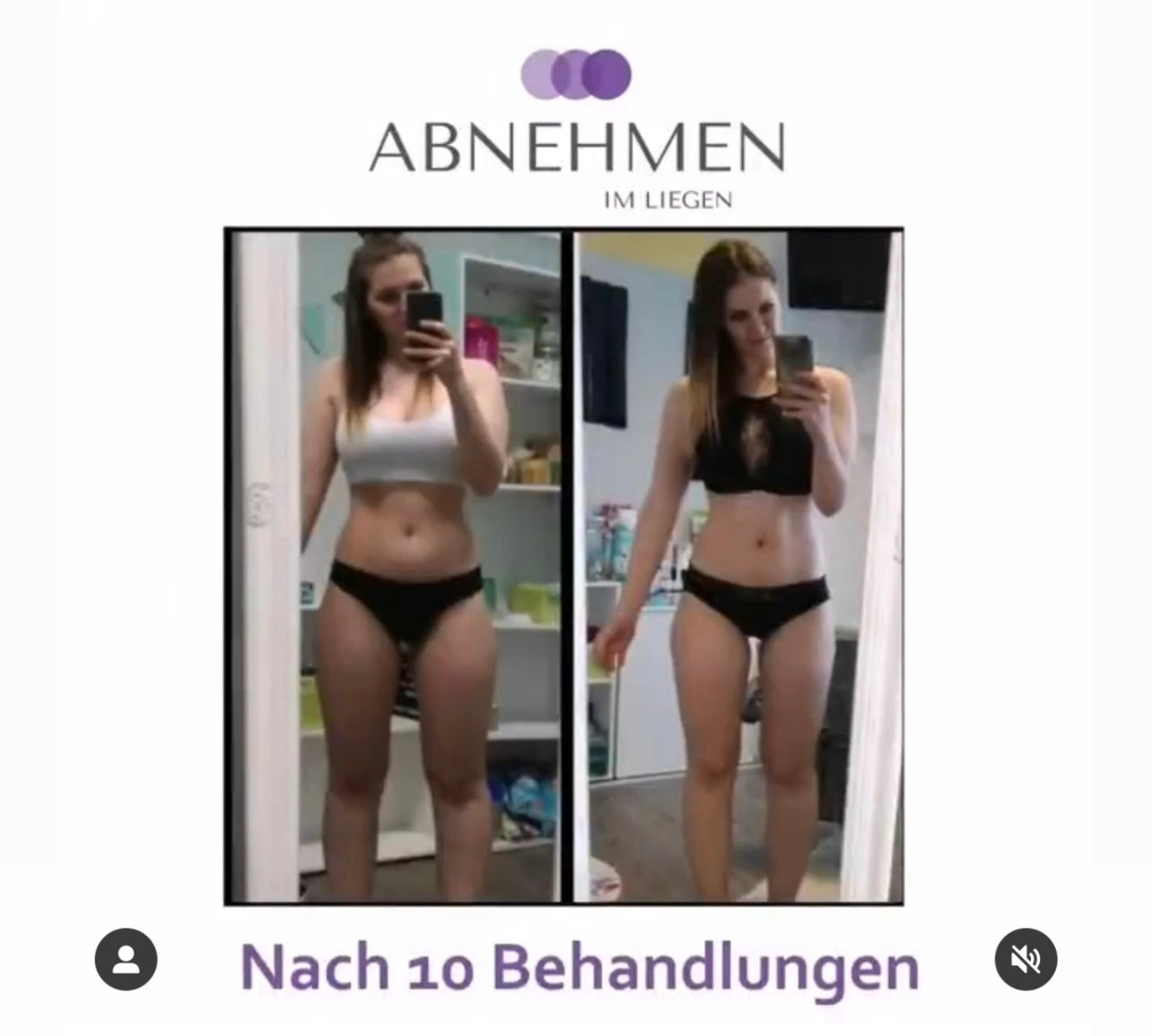 Paket - 10er